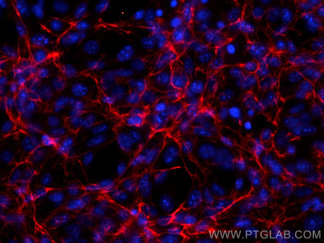 Fibronectin Antibody in Immunocytochemistry (ICC/IF)