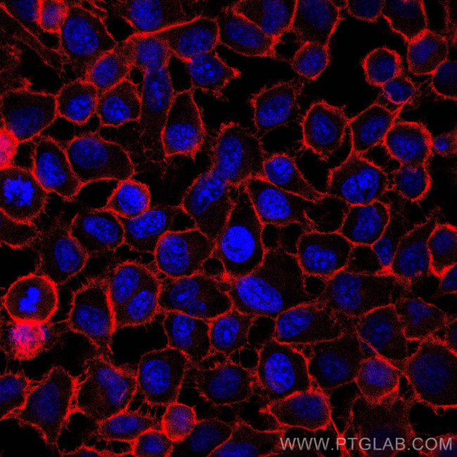 CD44 Antibody in Immunocytochemistry (ICC/IF)