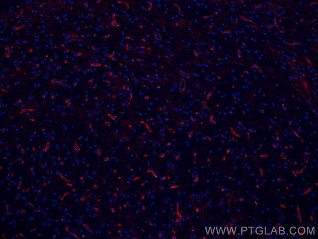 Aquaporin 4 Antibody in Immunohistochemistry (Paraffin) (IHC (P))