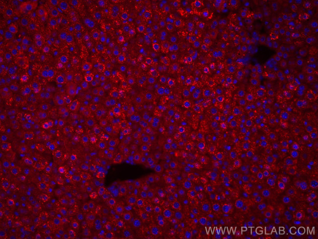 Albumin Antibody in Immunohistochemistry (Paraffin) (IHC (P))