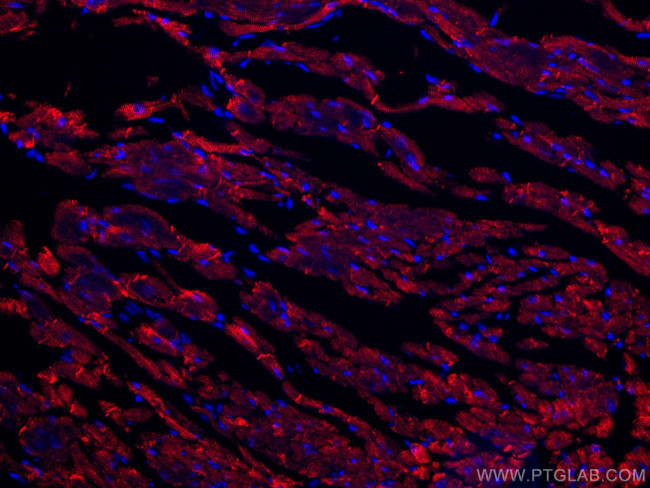 Desmin Antibody in Immunohistochemistry (Paraffin) (IHC (P))