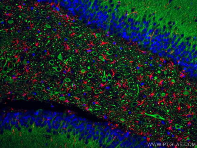 GFAP Antibody in Immunohistochemistry (Paraffin) (IHC (P))