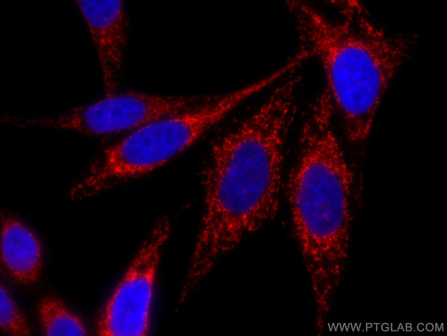 MFF Antibody in Immunocytochemistry (ICC/IF)