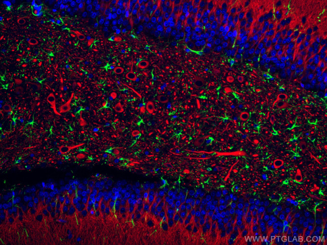 MAP2 Antibody in Immunohistochemistry (Paraffin) (IHC (P))