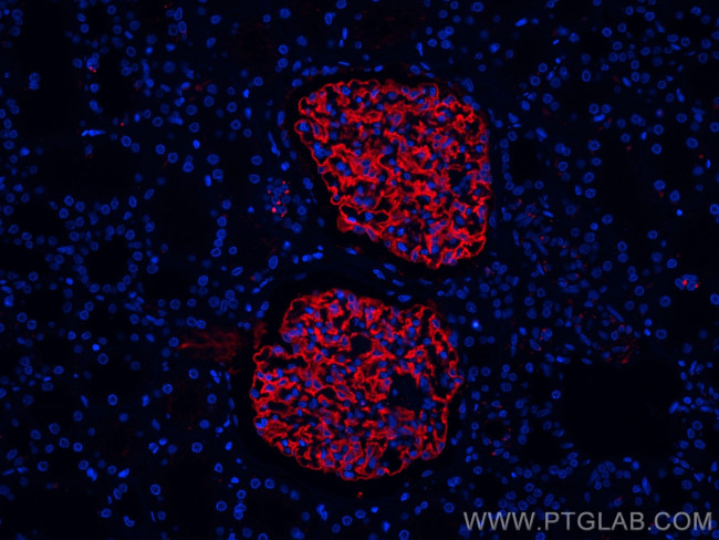 Podocalyxin Antibody in Immunohistochemistry (Paraffin) (IHC (P))