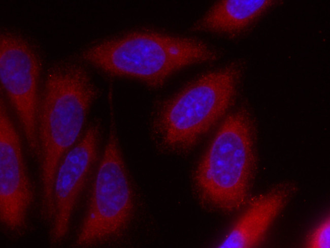 iNOS Antibody in Immunocytochemistry (ICC/IF)