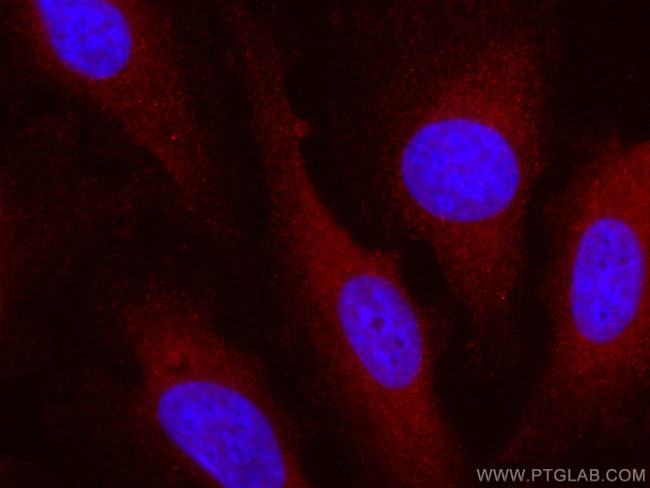 VEGFA Antibody in Immunocytochemistry (ICC/IF)