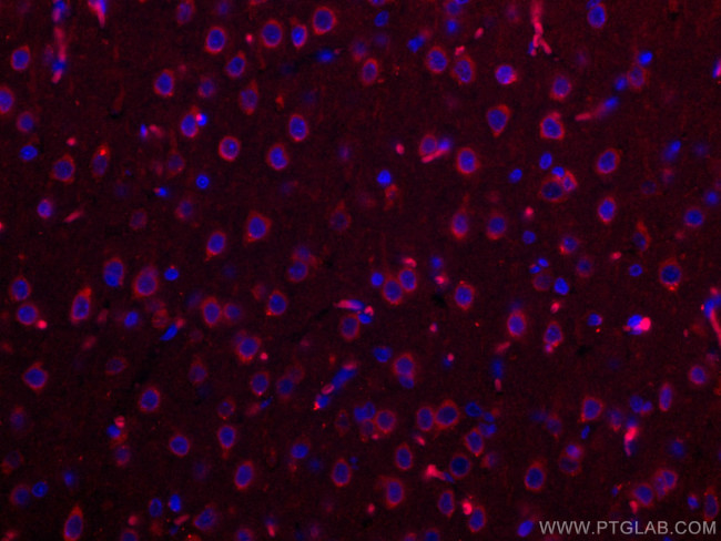 Nestin Antibody in Immunohistochemistry (Paraffin) (IHC (P))
