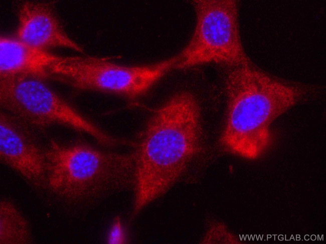 Caspase 3/p17/p19 Antibody in Immunocytochemistry (ICC/IF)