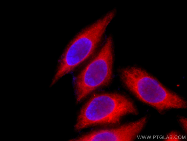 TMEM173/STING Antibody in Immunocytochemistry (ICC/IF)