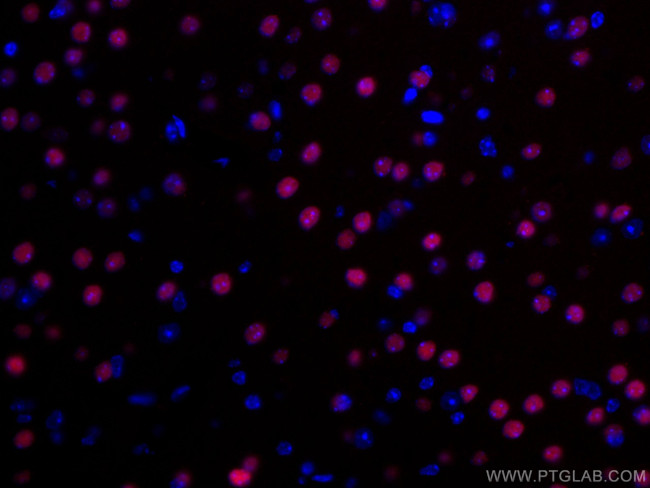 TBR1 Antibody in Immunohistochemistry (Paraffin) (IHC (P))