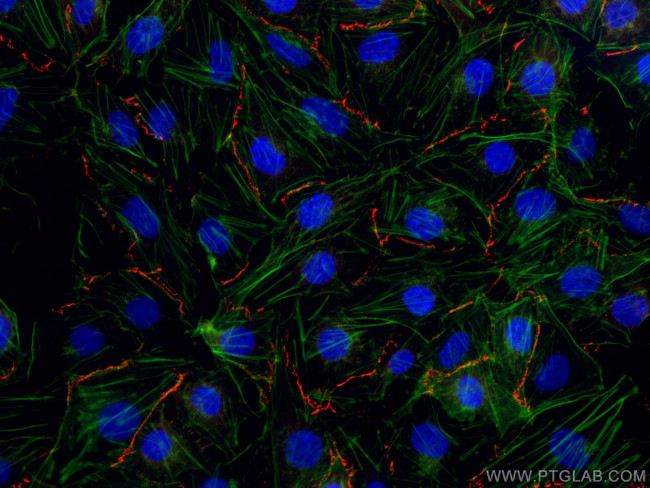 ZO-1 Antibody in Immunocytochemistry (ICC/IF)