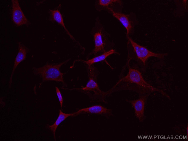 Osteocalcin Antibody in Immunocytochemistry (ICC/IF)