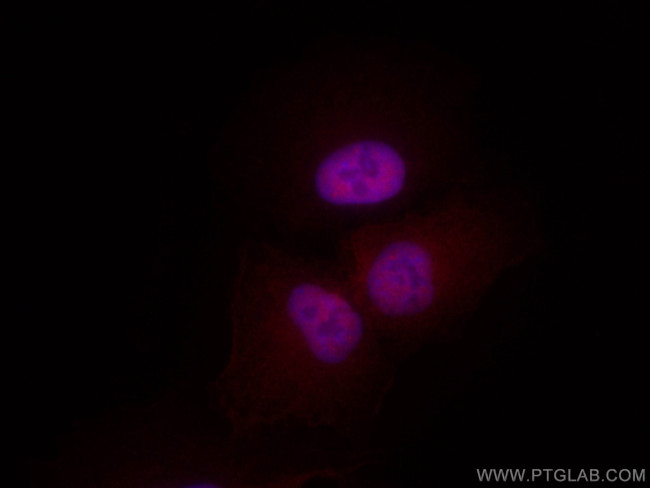 Glucocorticoid receptor Antibody in Immunocytochemistry (ICC/IF)