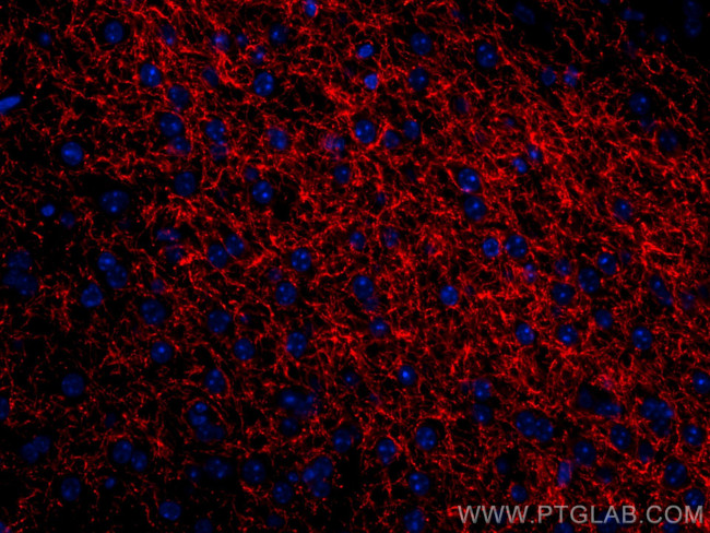 TH Antibody in Immunohistochemistry (Paraffin) (IHC (P))