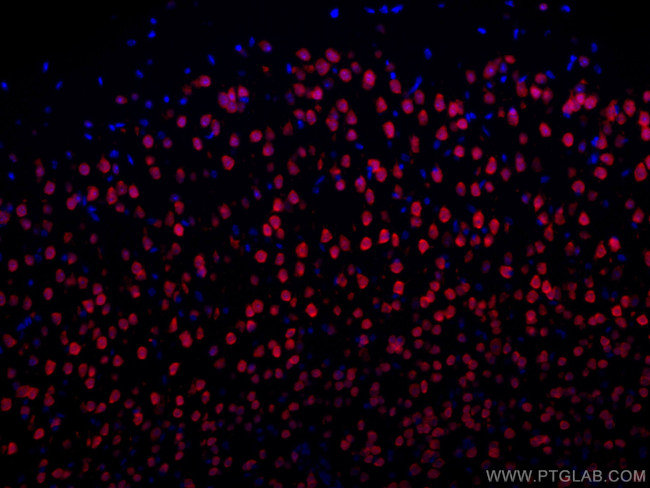 NeuN Antibody in Immunohistochemistry (Paraffin) (IHC (P))