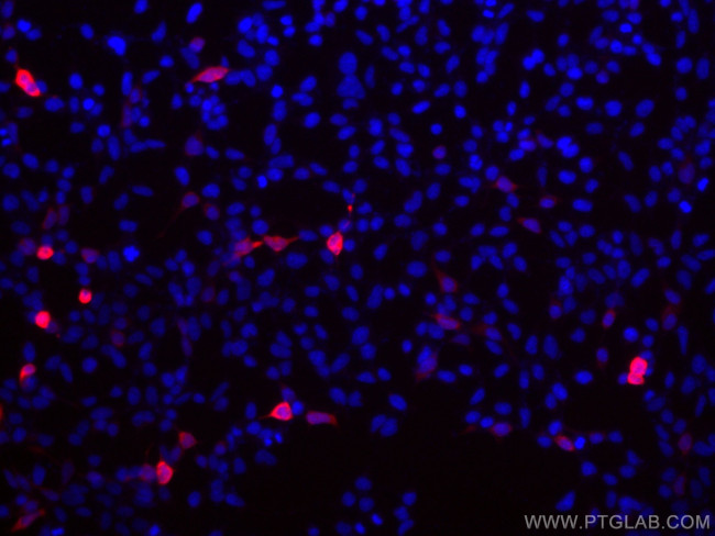 GFP tag Antibody in Immunocytochemistry (ICC/IF)