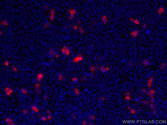HA tag Antibody in Immunocytochemistry (ICC/IF)