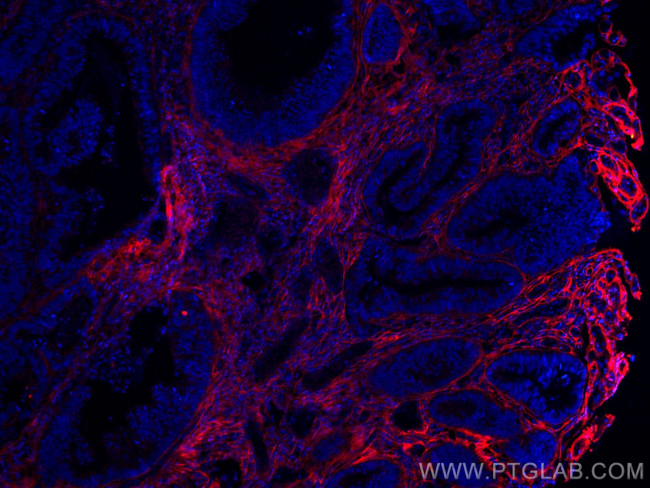 TGFBI/BIGH3 Antibody in Immunohistochemistry (Paraffin) (IHC (P))