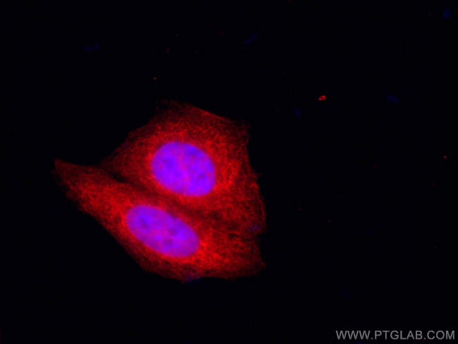 GRP94 Antibody in Immunocytochemistry (ICC/IF)