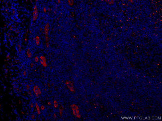 ACKR2 Antibody in Immunohistochemistry (Paraffin) (IHC (P))