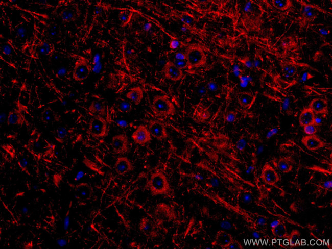 Syntaxin 6 Antibody in Immunohistochemistry (Paraffin) (IHC (P))