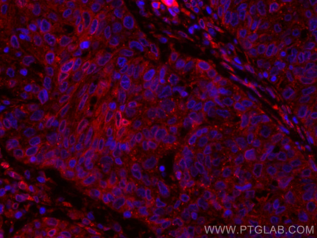 PGRMC2 Antibody in Immunohistochemistry (Paraffin) (IHC (P))