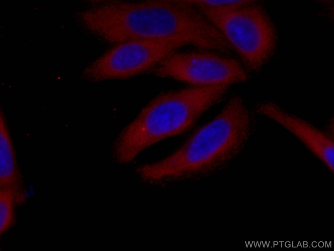 SND1 Antibody in Immunocytochemistry (ICC/IF)