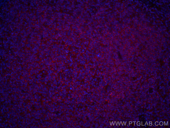 CD45 Antibody in Immunohistochemistry (Paraffin) (IHC (P))