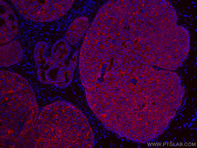 E-cadherin Antibody in Immunohistochemistry (Paraffin) (IHC (P))