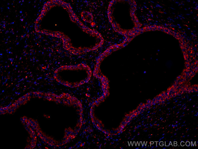 Prostein Antibody in Immunohistochemistry (Paraffin) (IHC (P))