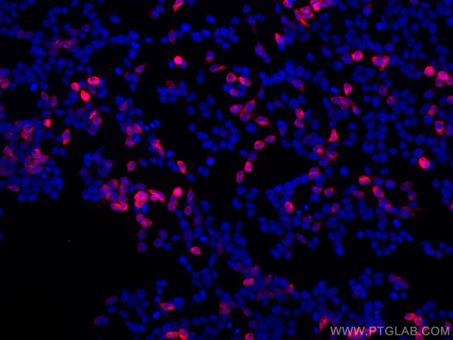 6x His, His-Tag Antibody in Immunocytochemistry (ICC/IF)
