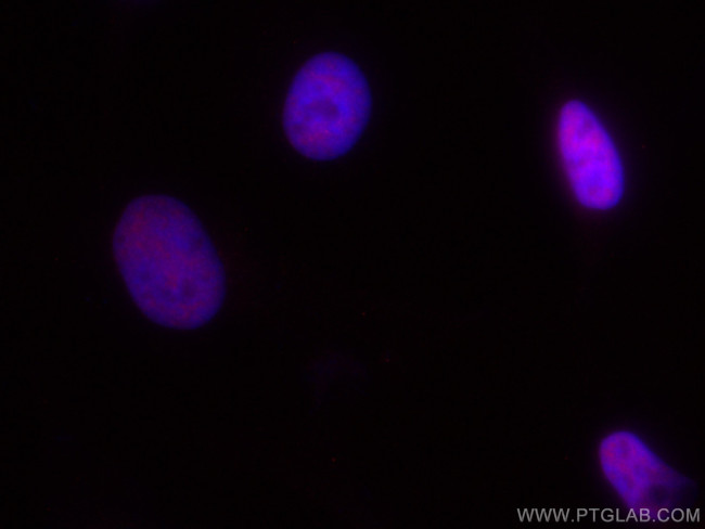 RBM15 Antibody in Immunocytochemistry (ICC/IF)