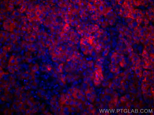 RBP4 Antibody in Immunohistochemistry (Paraffin) (IHC (P))