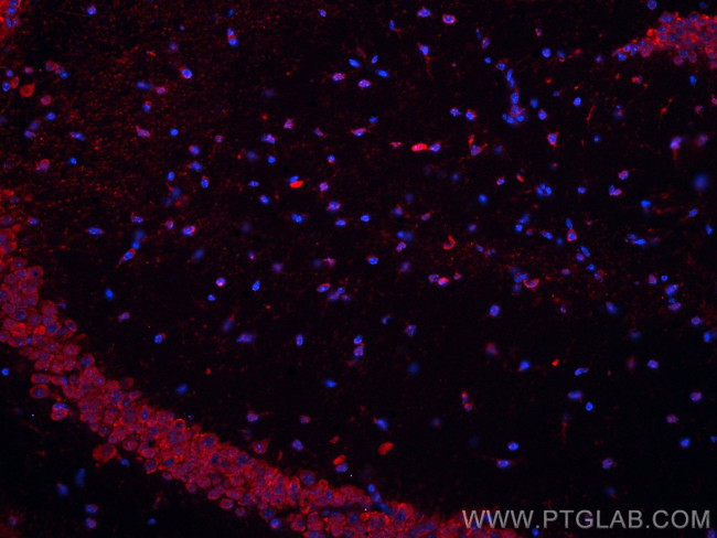 MAOB Antibody in Immunohistochemistry (Paraffin) (IHC (P))