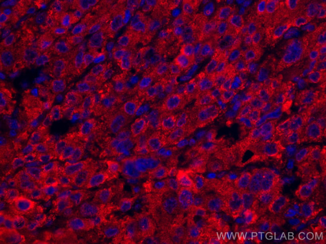 Transferrin Antibody in Immunohistochemistry (Paraffin) (IHC (P))