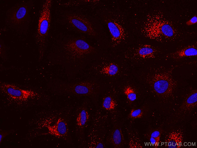 TRAF3 Antibody in Immunocytochemistry (ICC/IF)