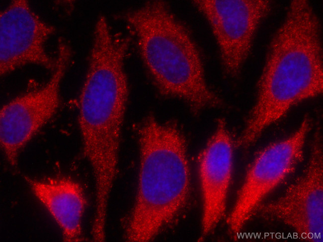POMC Antibody in Immunocytochemistry (ICC/IF)