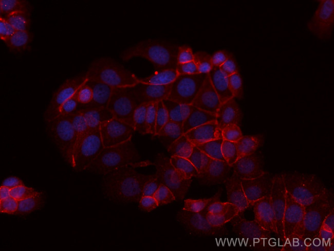 Beta Catenin Antibody in Immunocytochemistry (ICC/IF)