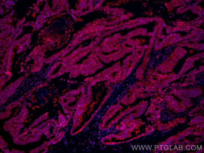 COPS2 Antibody in Immunocytochemistry (ICC/IF)