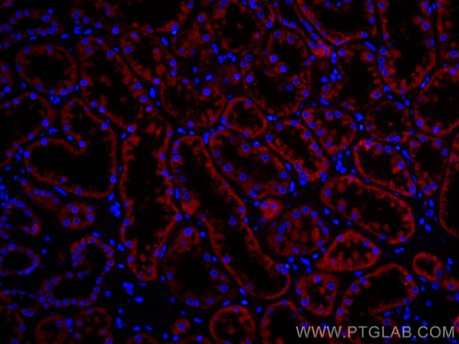 PCCB Antibody in Immunohistochemistry (Paraffin) (IHC (P))