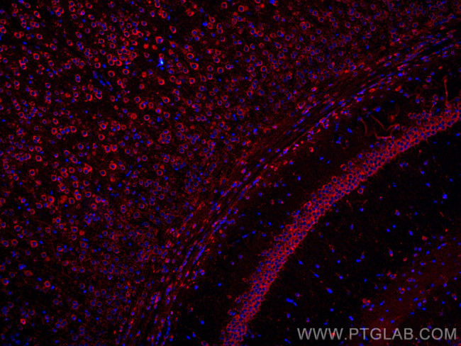 MFF Antibody in Immunohistochemistry (Paraffin) (IHC (P))