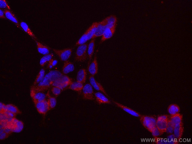 AP5Z1/SPG48 Antibody in Immunocytochemistry (ICC/IF)