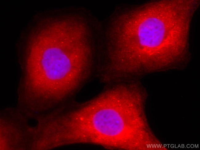HE4 Antibody in Immunocytochemistry (ICC/IF)