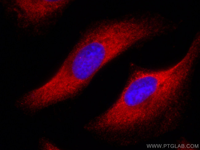 FASN Antibody in Immunocytochemistry (ICC/IF)