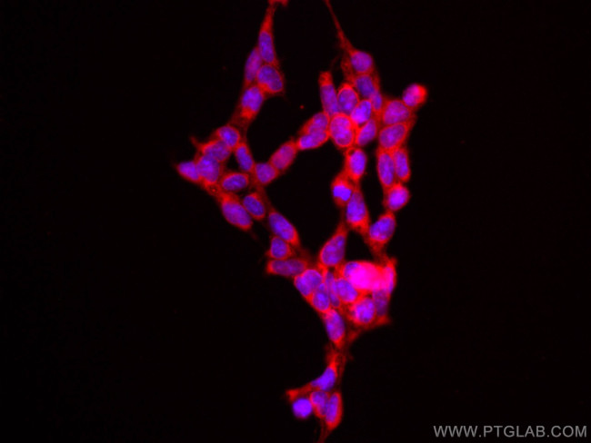 RAF1 Antibody in Immunocytochemistry (ICC/IF)