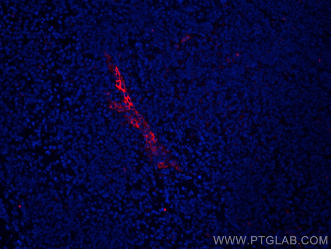 MAdCAM1 Antibody in Immunohistochemistry (Paraffin) (IHC (P))