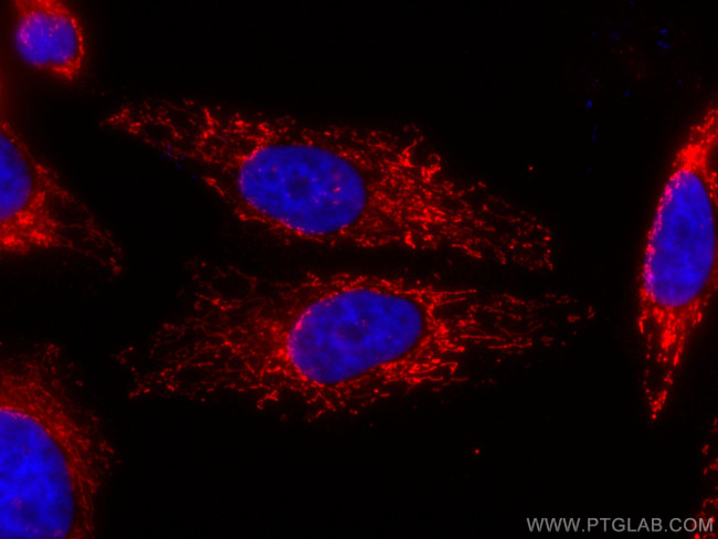 ATPB Antibody in Immunocytochemistry (ICC/IF)