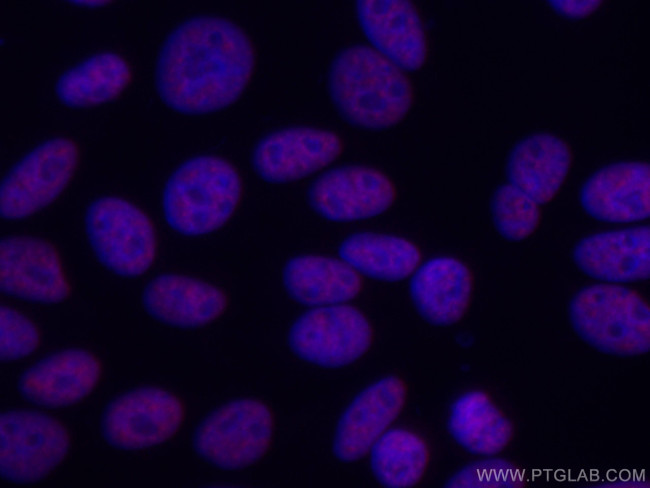 ASF/SF2 Antibody in Immunocytochemistry (ICC/IF)