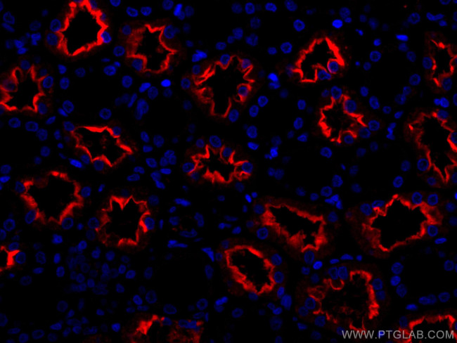 ACE2 Antibody in Immunohistochemistry (Paraffin) (IHC (P))